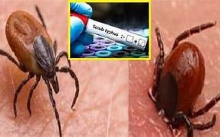 ସ୍କ୍ରବ୍‌ ଟାଇଫସ: ସୁନ୍ଦରଗଡ଼ରେ ଆଉ ୯ ପଜିଟିଭ ଚିହ୍ନଟ୍